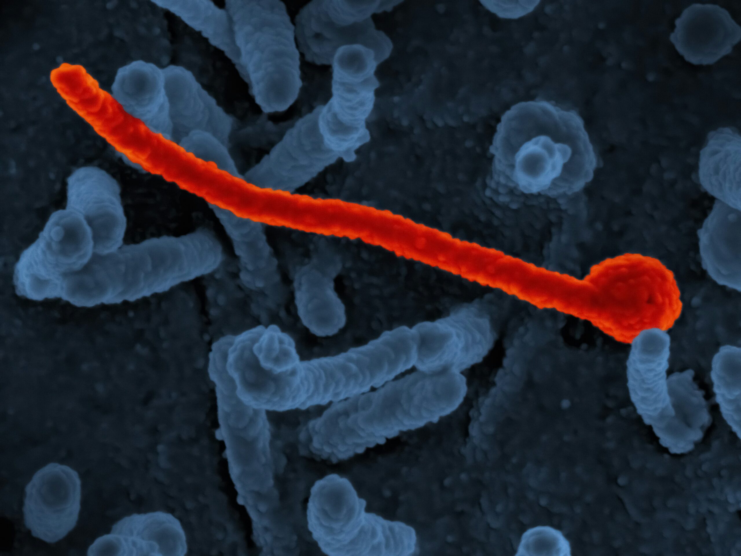 ebola alert