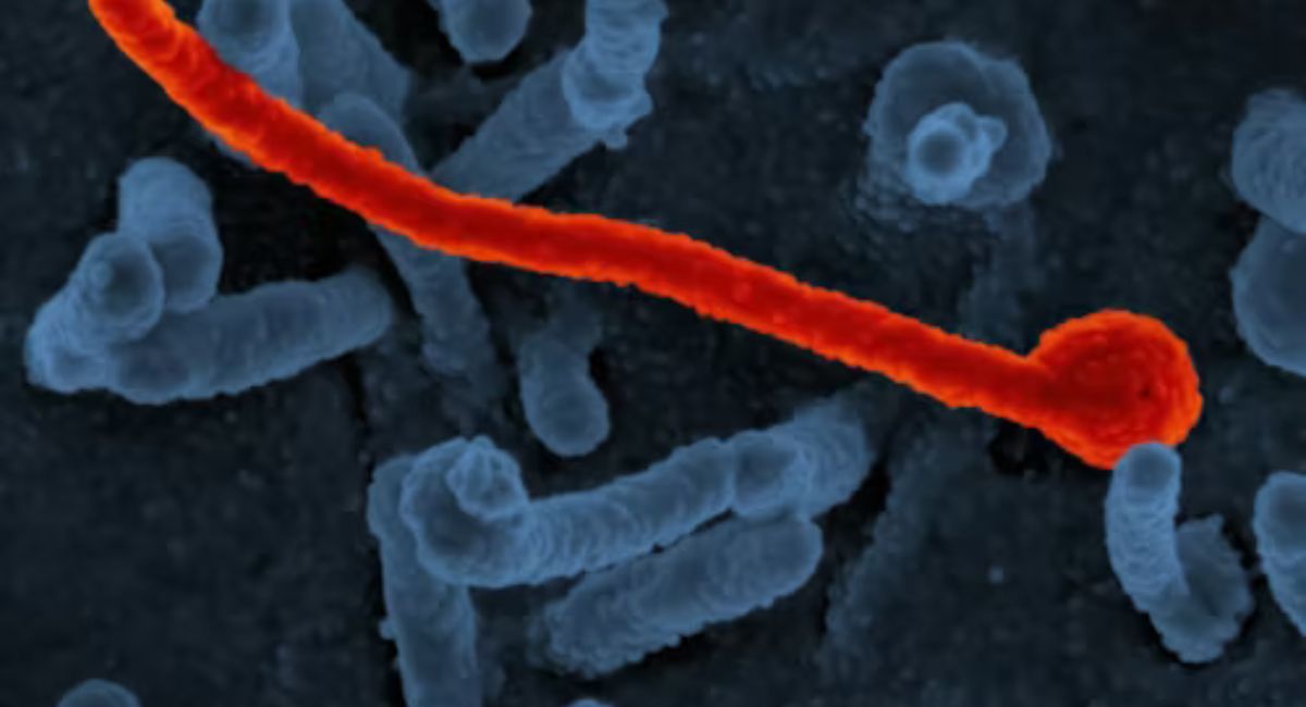 Ebola